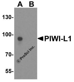 Western blot analysis of PIWI-L1 in human testis tissue lysate with PIWI-L2 antibody at 1 μg/ml in (A) the absence and (B) the presence of blocking peptide.
