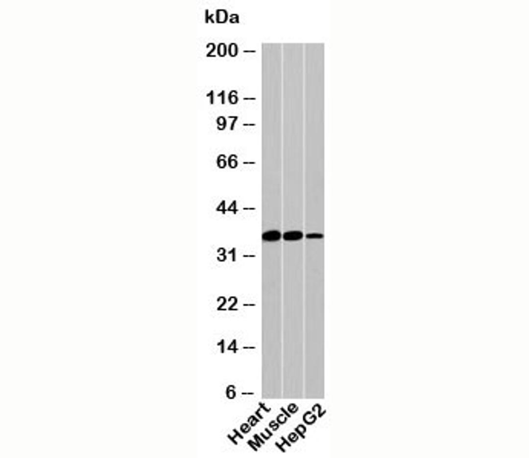 Western blot testing of human samples with PDLIM1 antibody at 1ug/ml.