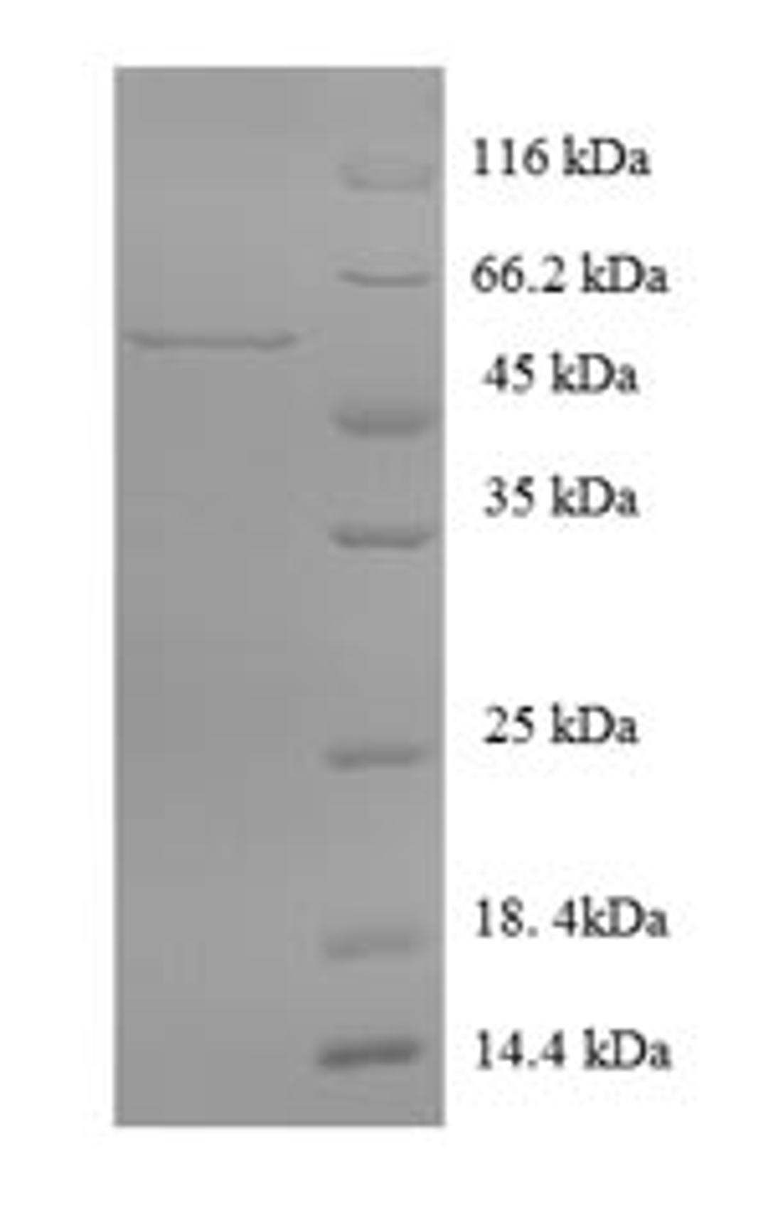 (Tris-Glycine gel) Discontinuous SDS-PAGE (reduced) with 5% enrichment gel and 15% separation gel.