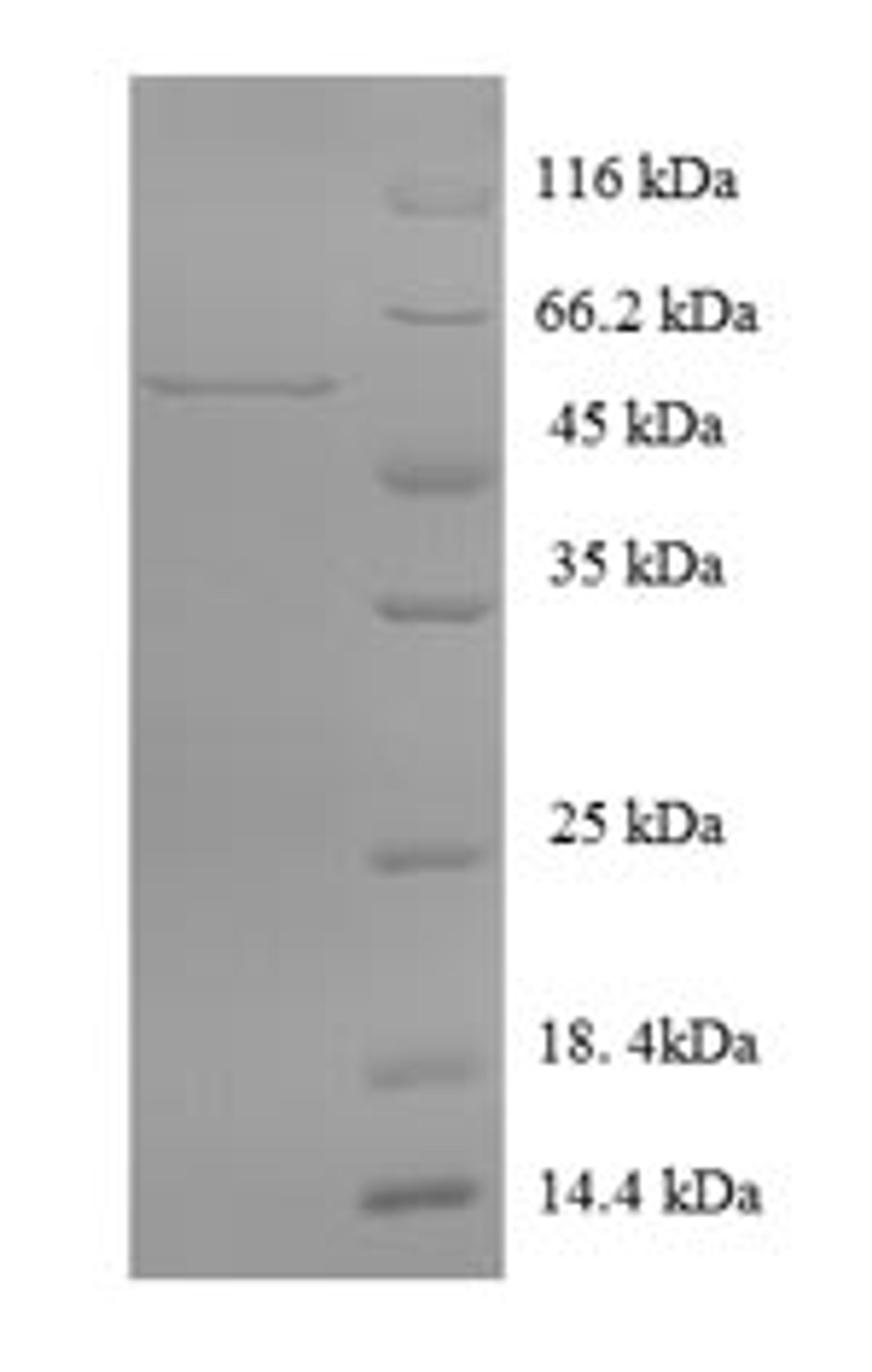 (Tris-Glycine gel) Discontinuous SDS-PAGE (reduced) with 5% enrichment gel and 15% separation gel.
