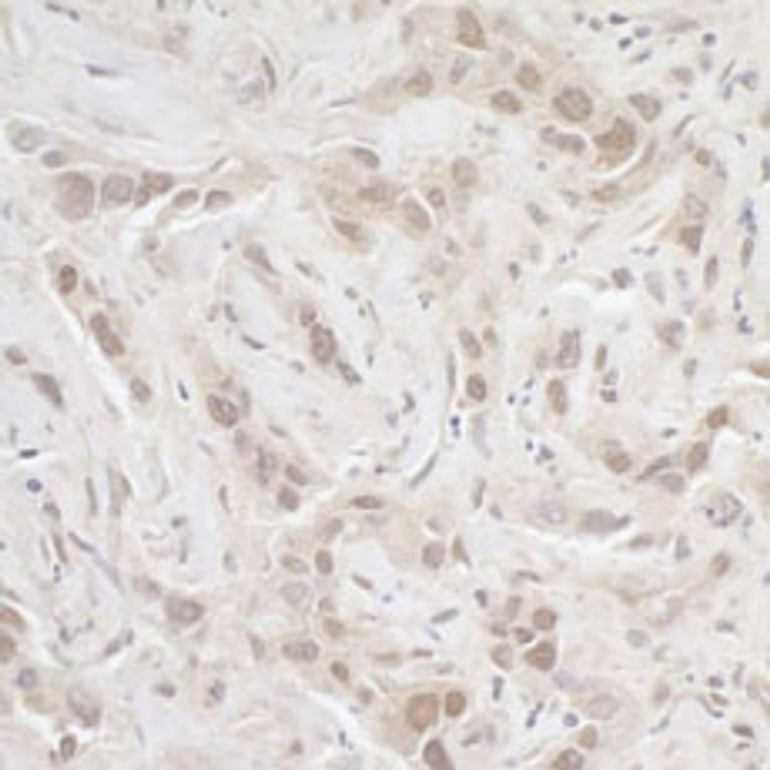 Detection of human PPP3CA by immunohistochemistry.