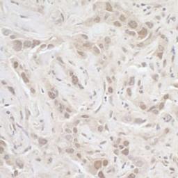 Detection of human PPP3CA by immunohistochemistry.