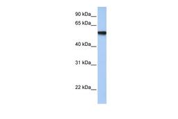 Antibody used in WB on Human Fetal Muscle at 1 ug/ml.