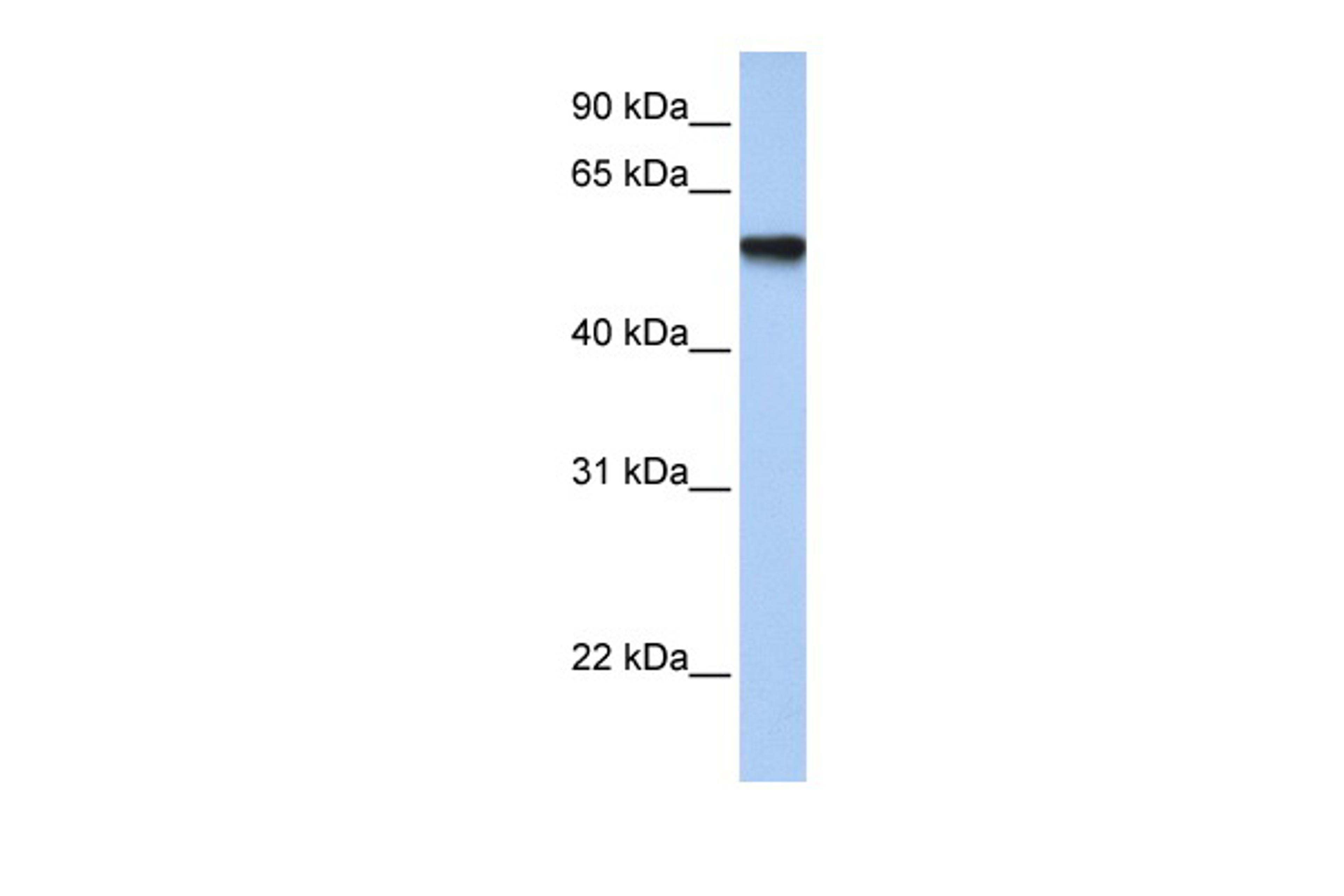 Antibody used in WB on Human Fetal Muscle at 1 ug/ml.