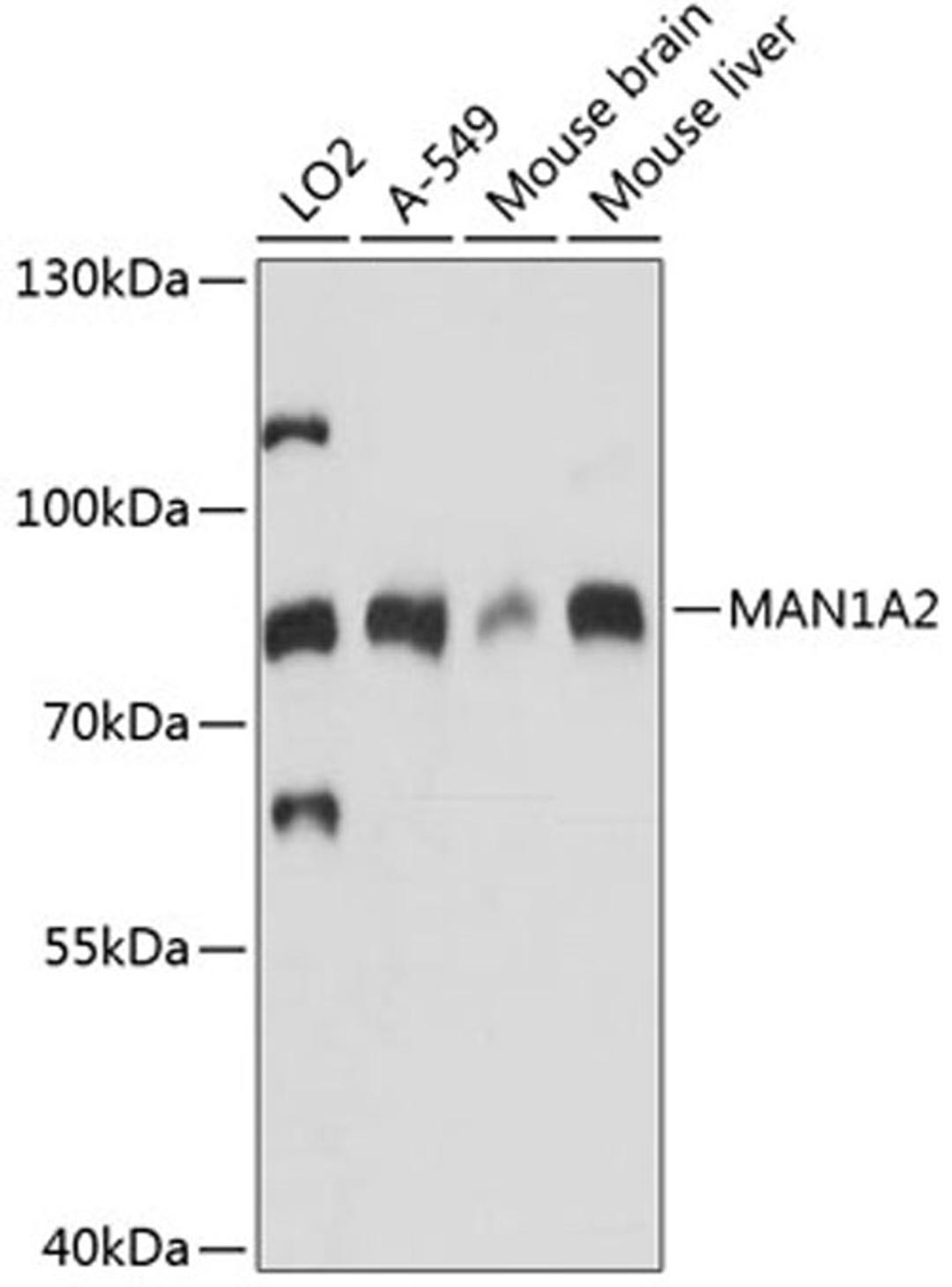 Western blot - MAN1A2 antibody (A14271)