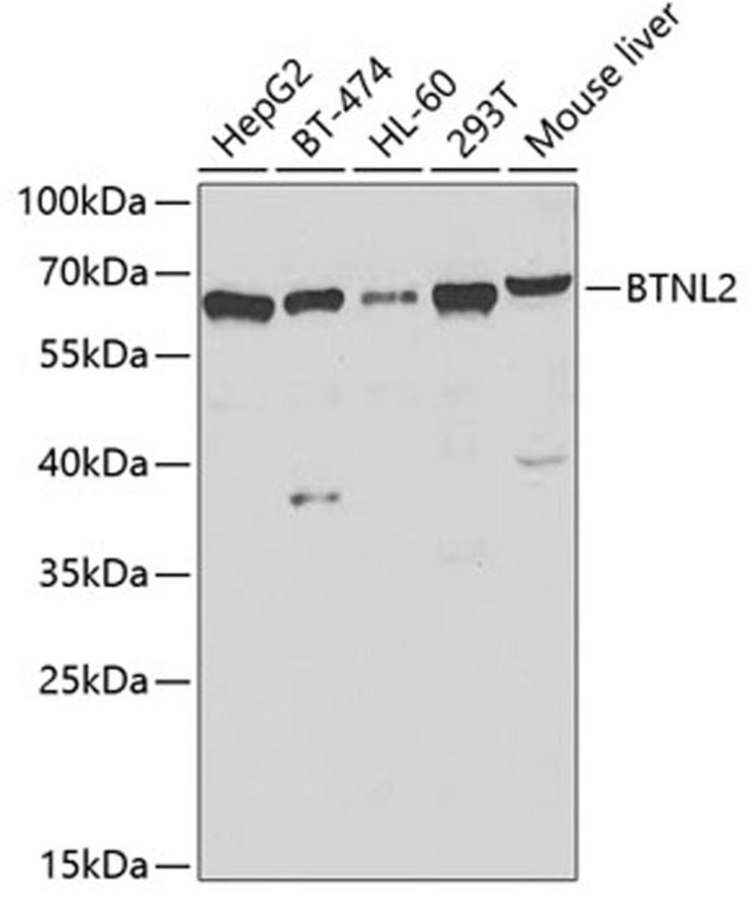 Western blot - BTNL2 antibody (A7120)