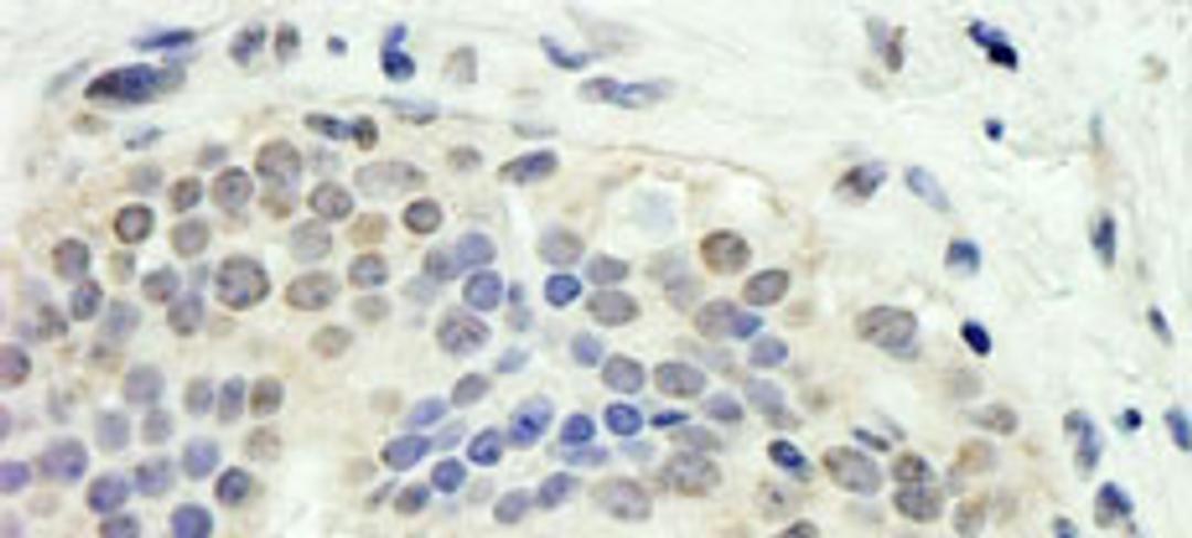 Detection of human E2F1 by immunohistochemistry.