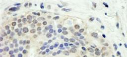 Detection of human E2F1 by immunohistochemistry.