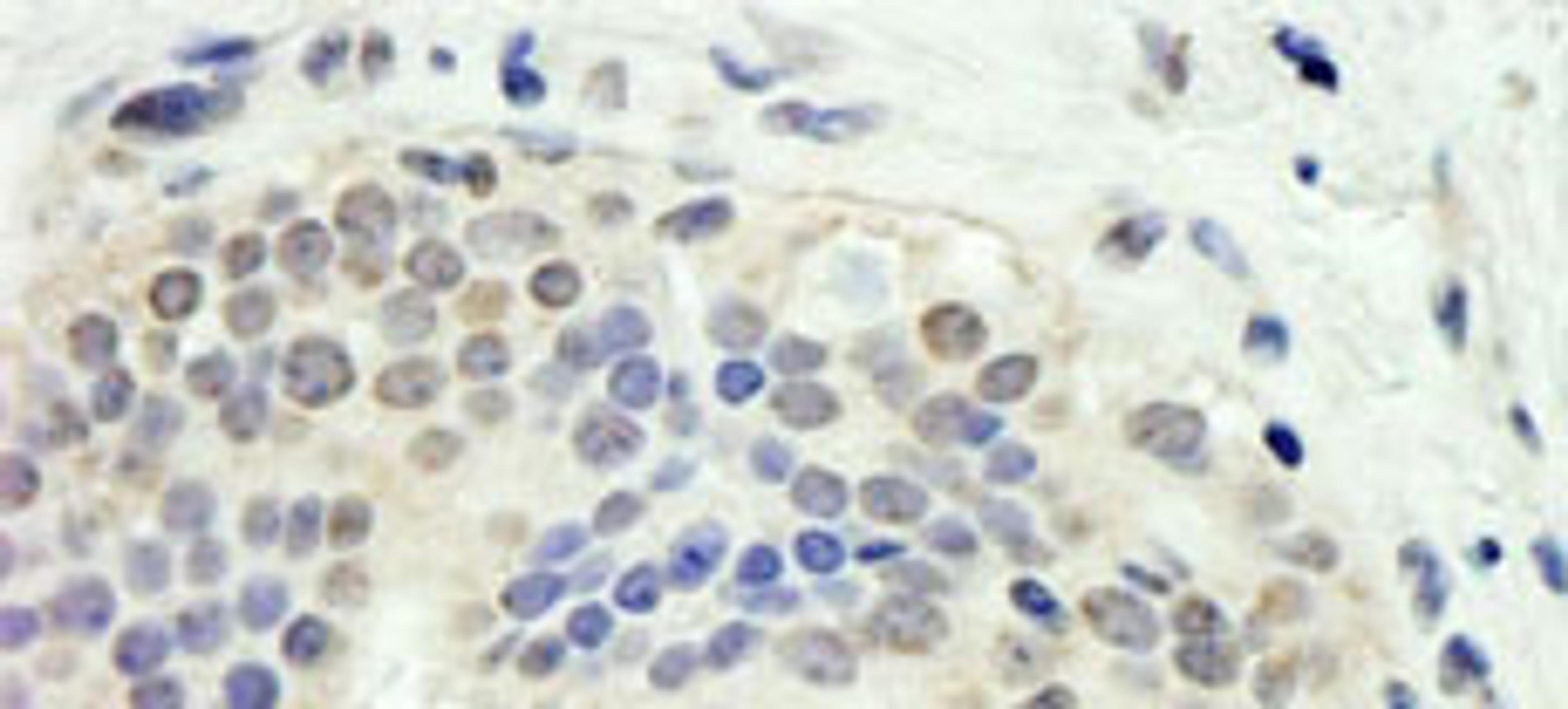 Detection of human E2F1 by immunohistochemistry.