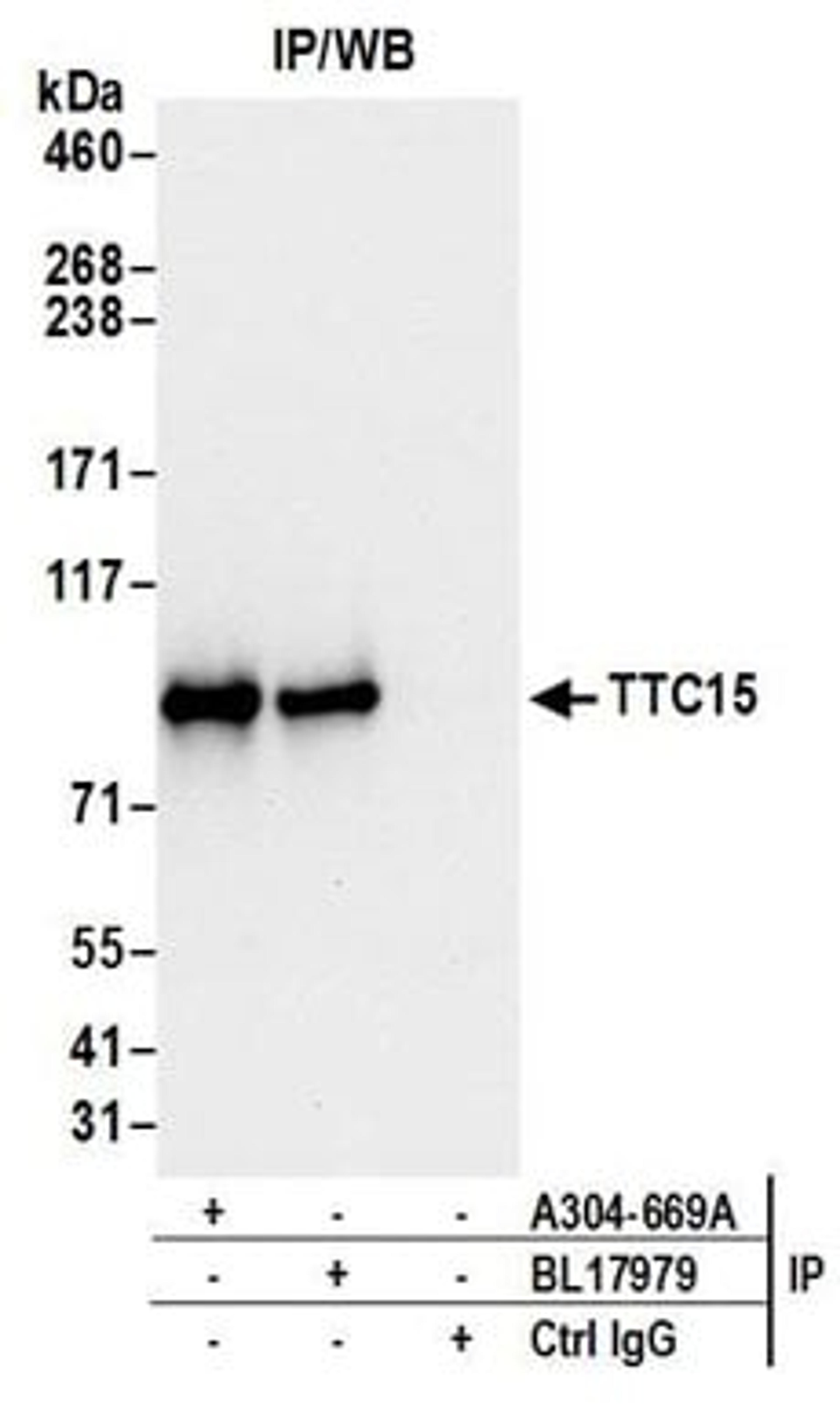 Detection of human TTC15 by western blot of immunoprecipitates.