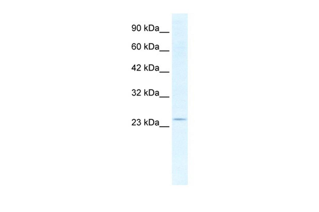 Antibody used in WB on Human HepG2 at 2.5 ug/ml.