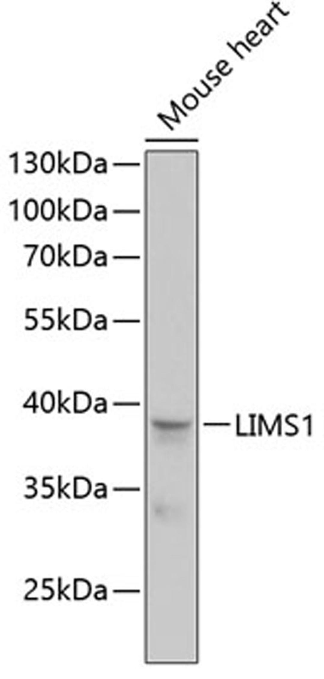 Western blot - LIMS1 antibody (A13917)