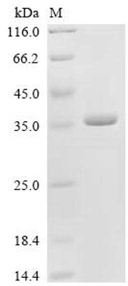 (Tris-Glycine gel) Discontinuous SDS-PAGE (reduced) with 5% enrichment gel and 15% separation gel.