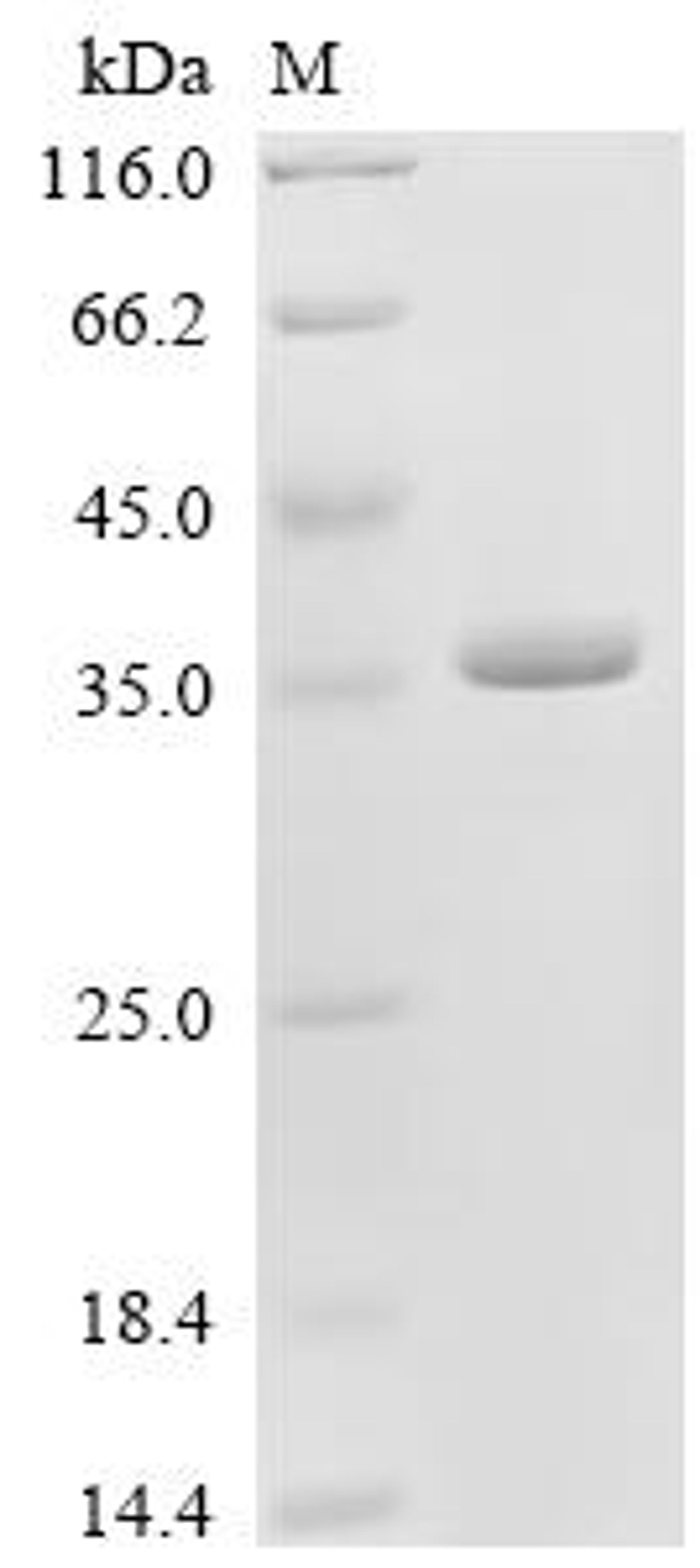 (Tris-Glycine gel) Discontinuous SDS-PAGE (reduced) with 5% enrichment gel and 15% separation gel.