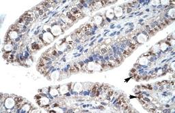 Immunohistochemistry-Paraffin: CCL18/PARC Antibody [NBP1-79940] - Human Intestine Tissue, antibody concentration 4-8ug/ml. Cells with positive label: Epithelial cells of intestinal villus (indicated with arrows) 400X magnification.