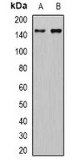 Western blot analysis of HEK293T (Lane1), mouse kidney (Lane2) whole cell lysates using FLT4 antibody