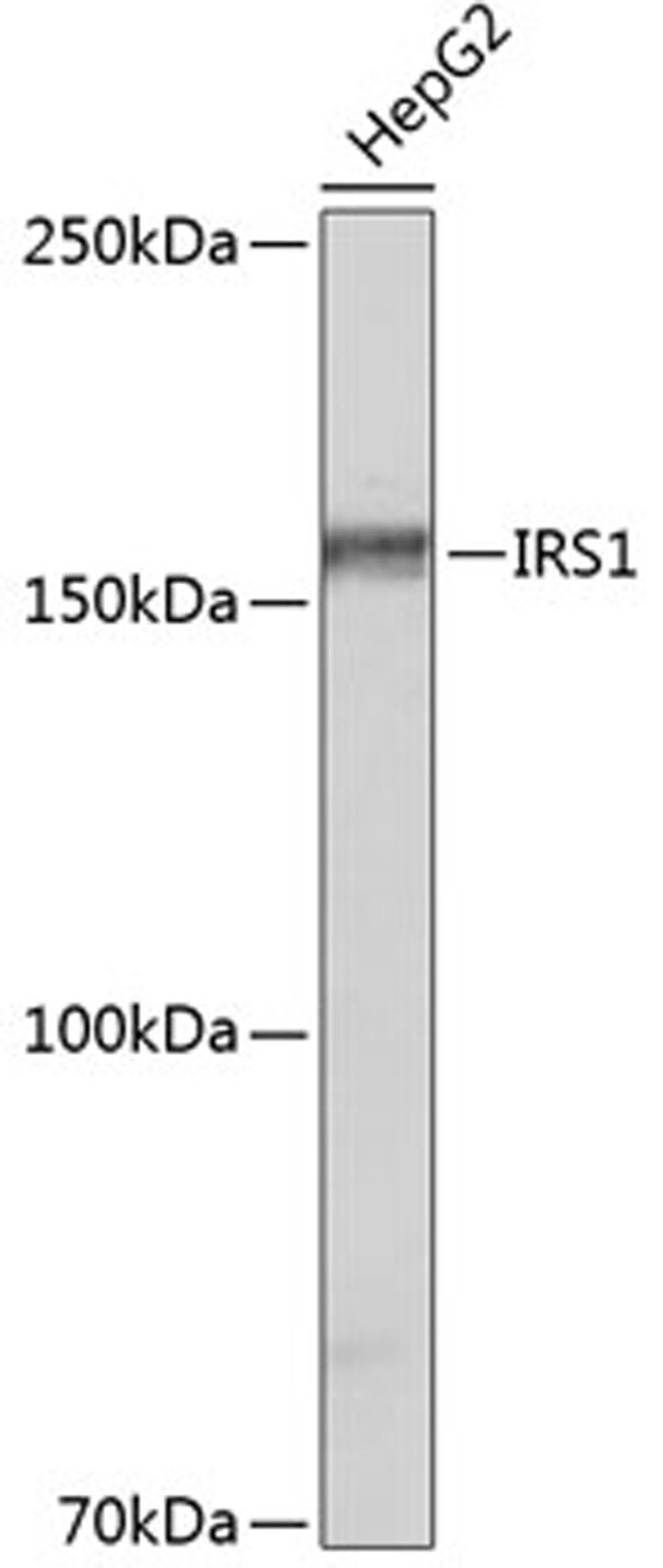 Western blot - IRS1 antibody (A19074)