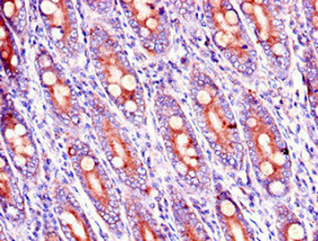 Immunohistochemistry of paraffin-embedded human small intestine tissue using CSB-PA822194LA01HU at dilution of 1:100