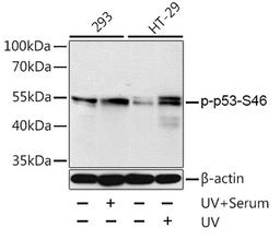 Western blot - Phospho-p53-S46 antibody (AP0476)