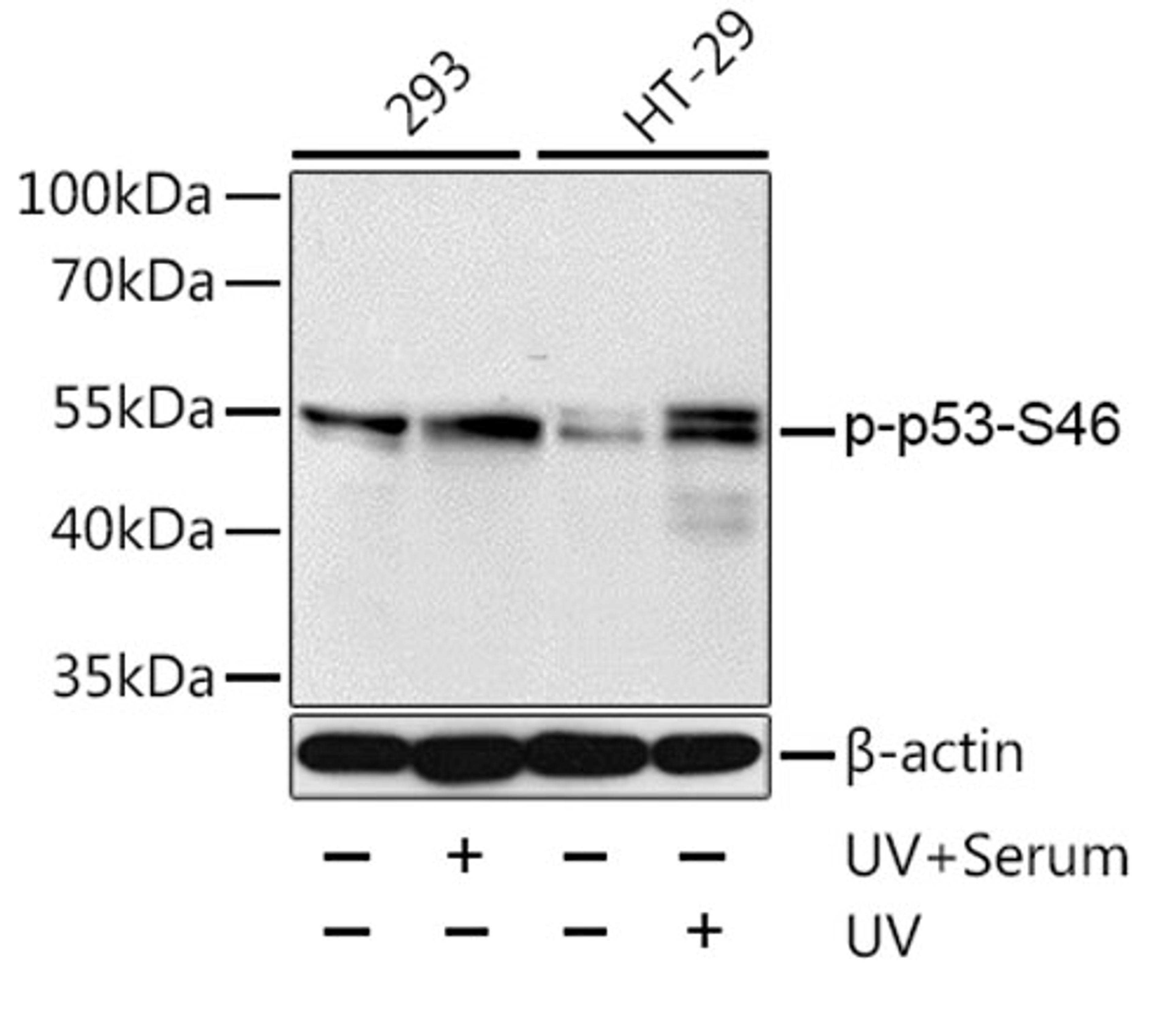 Western blot - Phospho-p53-S46 antibody (AP0476)