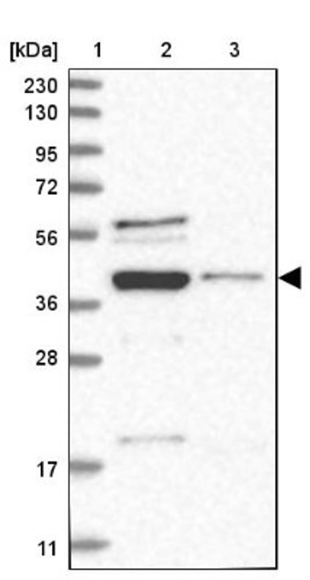 Western Blot: RNA binding motif protein, X-linked 2 Antibody [NBP1-85650] - Lane 1: Marker [kDa] 230, 130, 95, 72, 56, 36, 28, 17, 11<br/>Lane 2: Human cell line RT-4<br/>Lane 3: Human cell line U-251MG sp