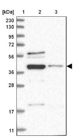 Western Blot: RNA binding motif protein, X-linked 2 Antibody [NBP1-85650] - Lane 1: Marker [kDa] 230, 130, 95, 72, 56, 36, 28, 17, 11<br/>Lane 2: Human cell line RT-4<br/>Lane 3: Human cell line U-251MG sp