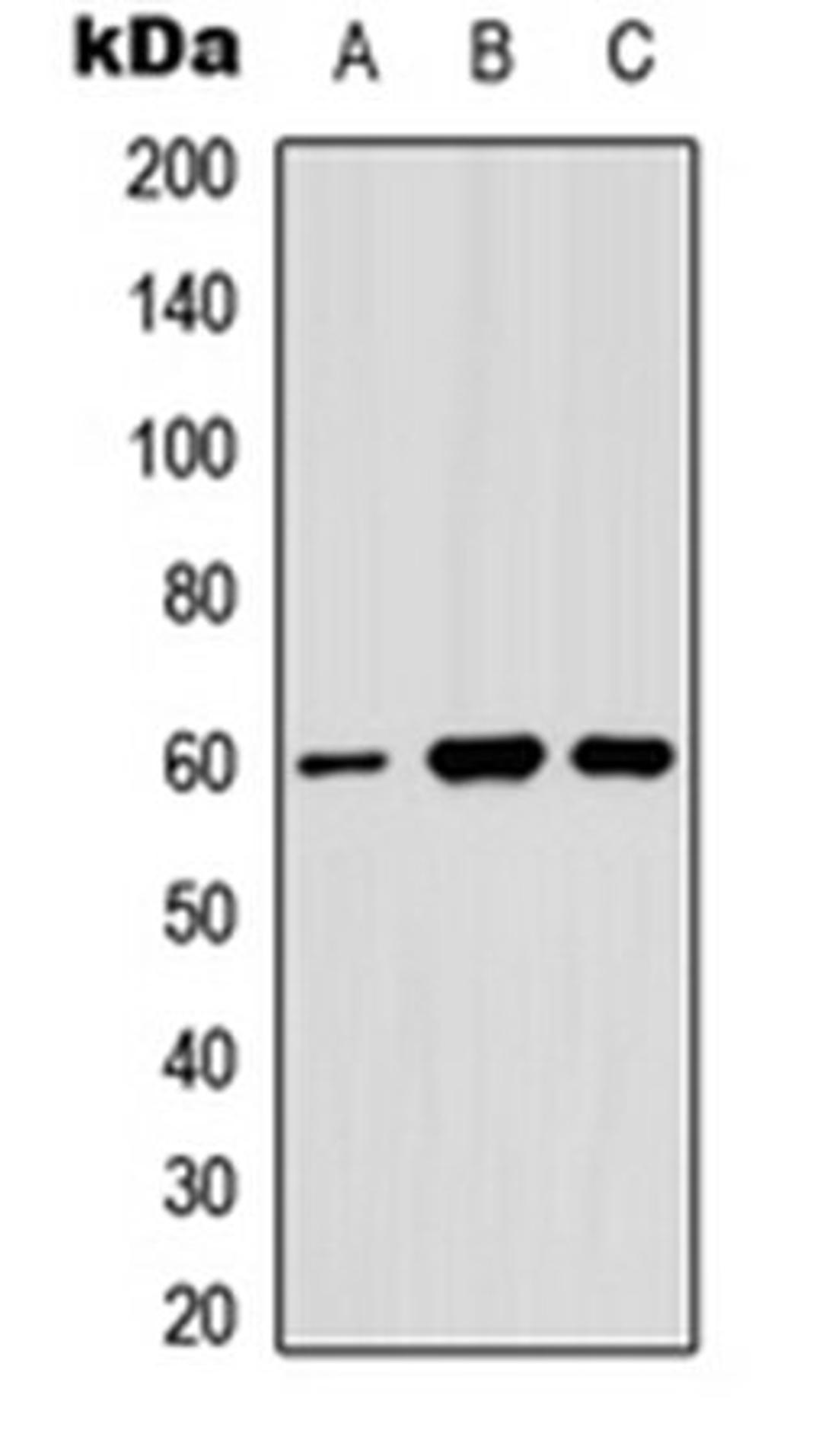 Western blot analysis of MCF7 (Lane 1), HeLa (Lane 2), U87MG (Lane 3) whole cell lysates using Angiopoietin-1 antibody