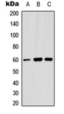 Western blot analysis of MCF7 (Lane 1), HeLa (Lane 2), U87MG (Lane 3) whole cell lysates using Angiopoietin-1 antibody