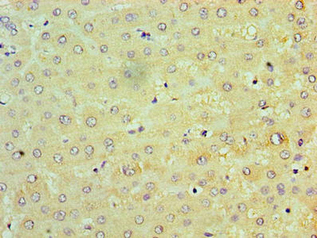 Immunohistochemistry of paraffin-embedded human liver tissue using CSB-PA024154LA01HU at dilution of 1:100