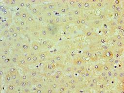 Immunohistochemistry of paraffin-embedded human liver tissue using CSB-PA024154LA01HU at dilution of 1:100