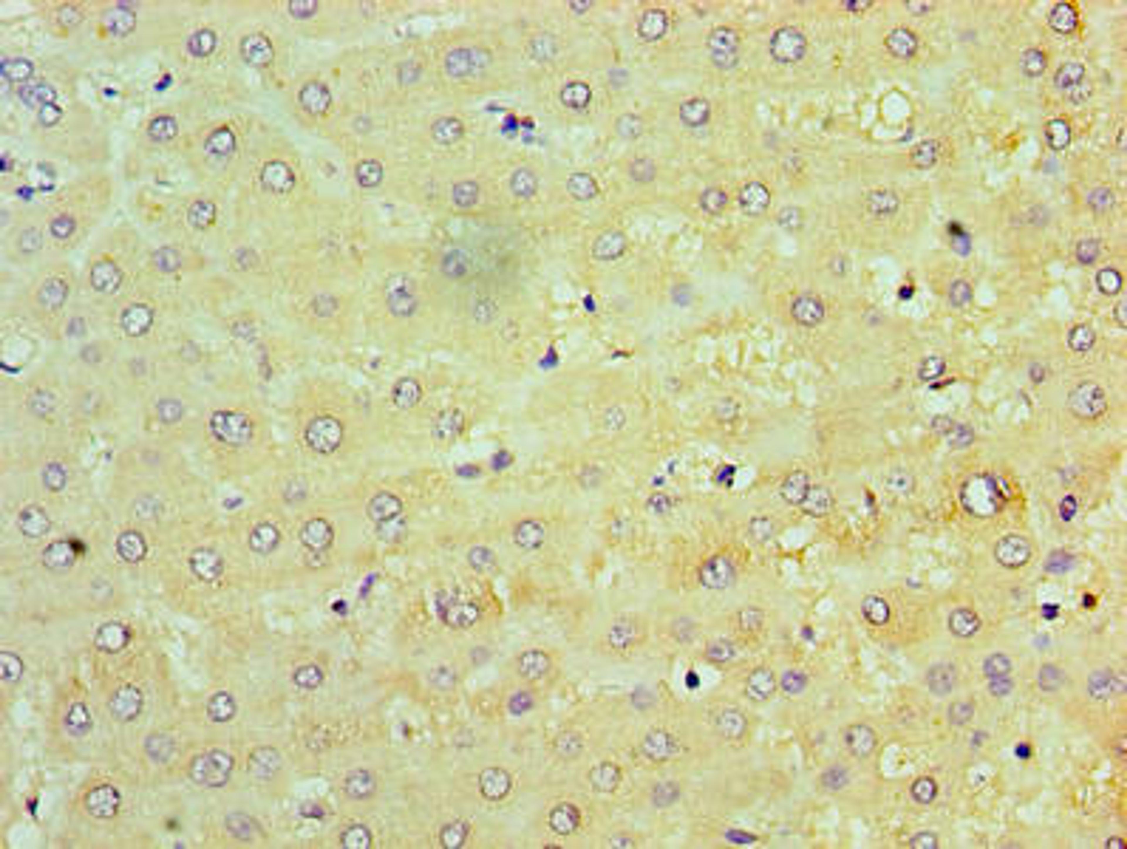 Immunohistochemistry of paraffin-embedded human liver tissue using CSB-PA024154LA01HU at dilution of 1:100