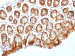 IHC testing of FFPE mouse colon tissue with b-Catenin antibody (clone CTNNB1/1509). Required HIER: boil tissue sections in 10mM Tris with 1mM EDTA, pH 9.0, for 10-20 min.