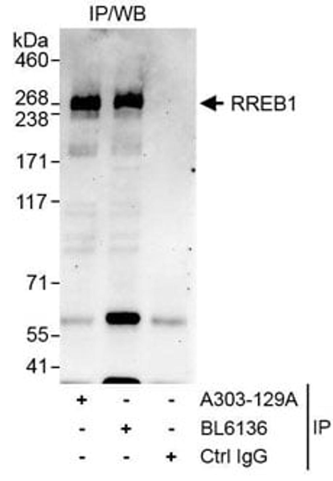 Detection of human RREB1 by western blot of immunoprecipitates.