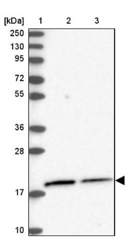 Western Blot: C11orf57 Antibody [NBP1-84606] - Lane 1: Marker [kDa] 250, 130, 95, 72, 55, 36, 28, 17, 10<br/>Lane 2: Human cell line RT-4<br/>Lane 3: Human cell line U-251MG sp