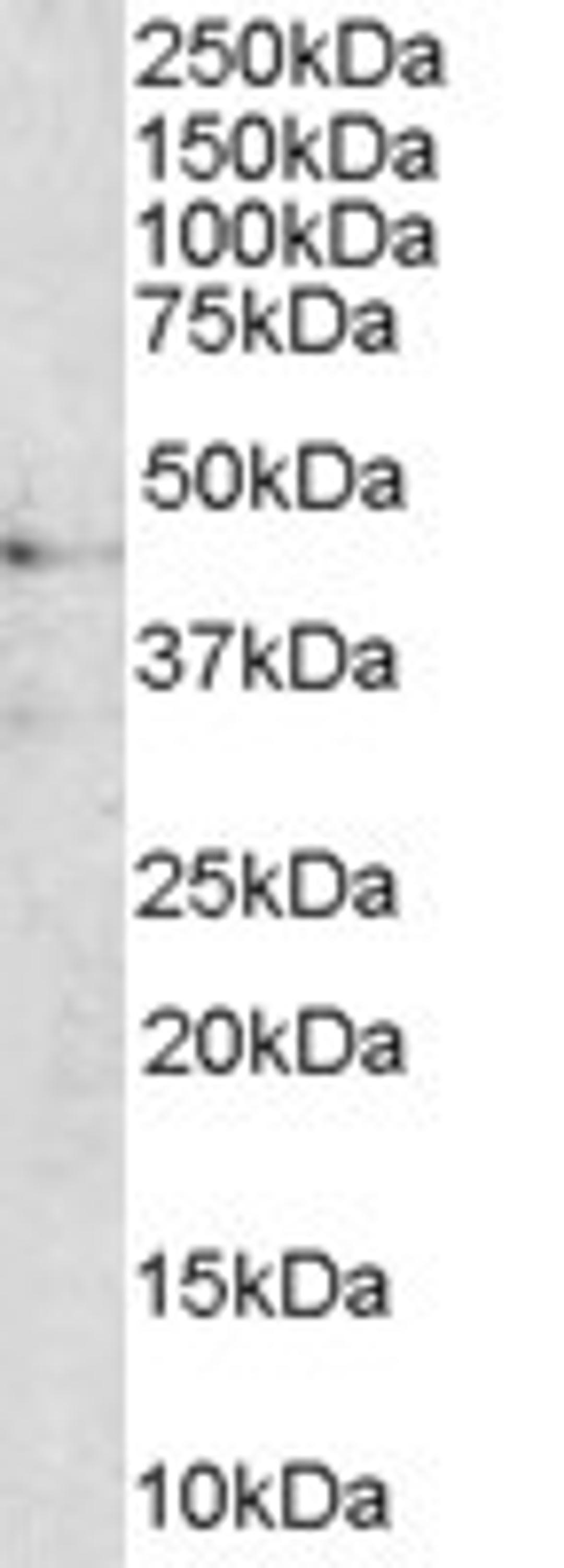 45-881 (1ug/ml) staining of Human Brain lysate (35ug protein in RIPA buffer). Primary incubation was 1 hour. Detected by chemiluminescence.