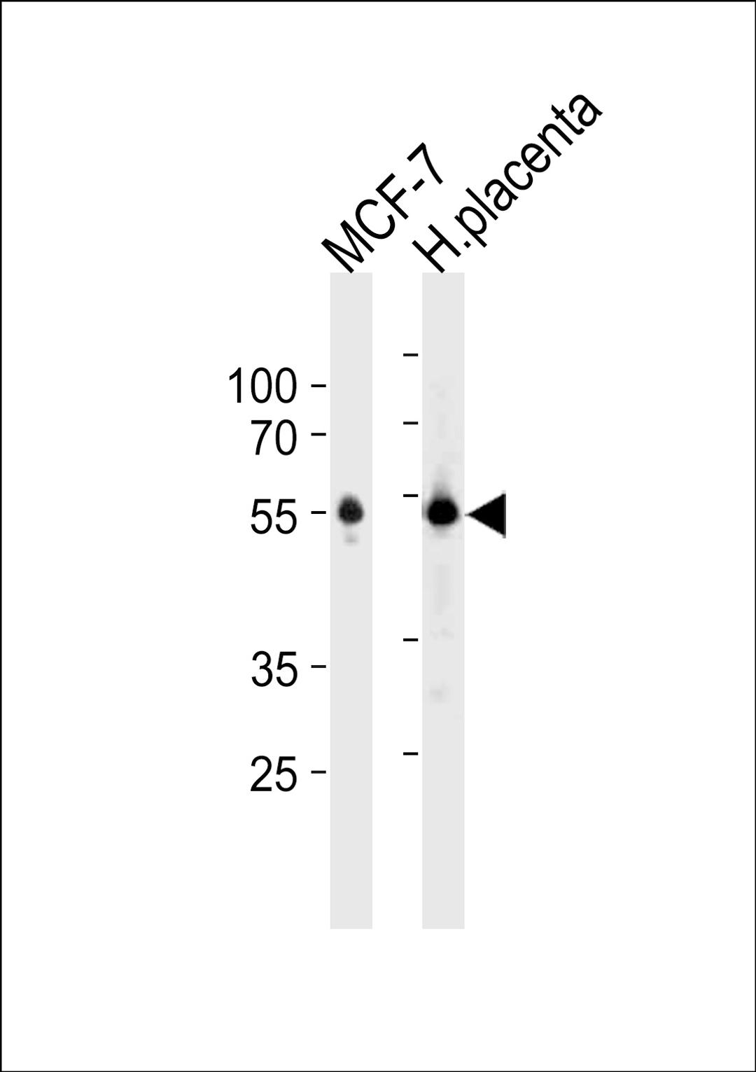 Western blot analysis in MCF-7 cell line and human placenta tissue lysates (35ug/lane).