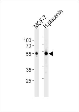 Western blot analysis in MCF-7 cell line and human placenta tissue lysates (35ug/lane).