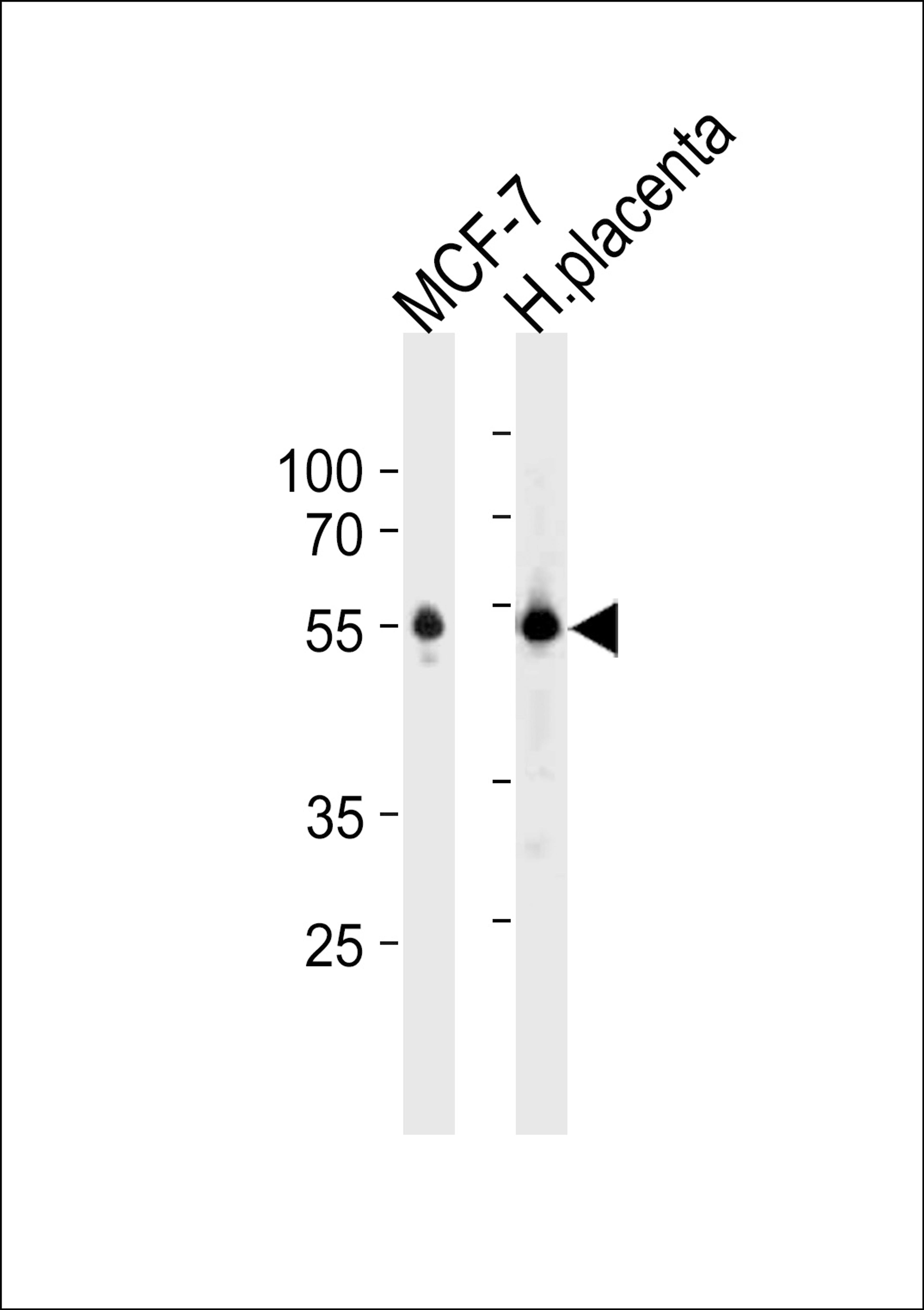 Western blot analysis in MCF-7 cell line and human placenta tissue lysates (35ug/lane).