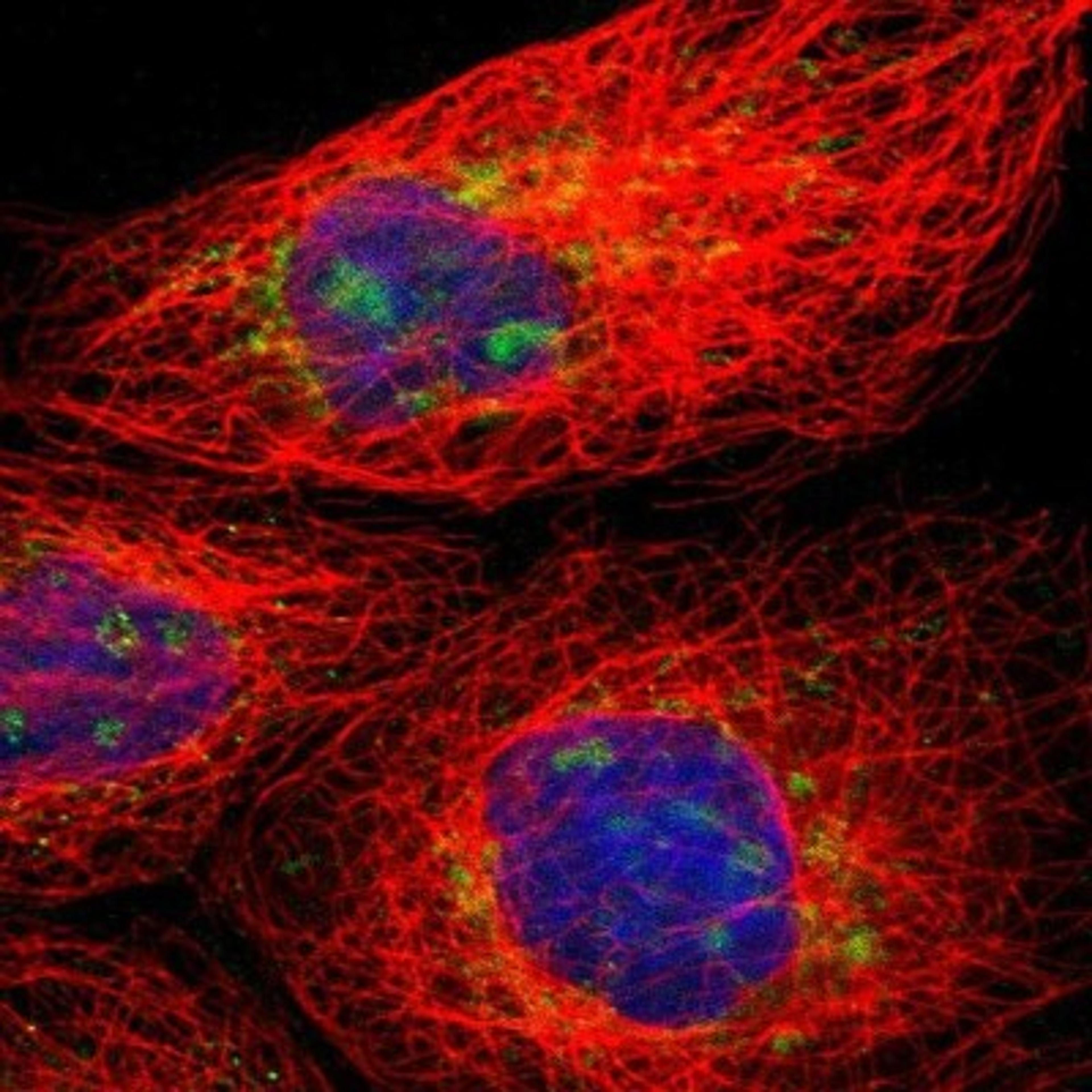 Immunocytochemistry/Immunofluorescence: Myosin light chain 3 Antibody [NBP1-88068] - Staining of human cell line A-431 shows positivity in nucleoli & mitochondria.