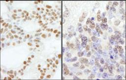 Detection of human and mouse PolE3/p17 by immunohistochemistry.