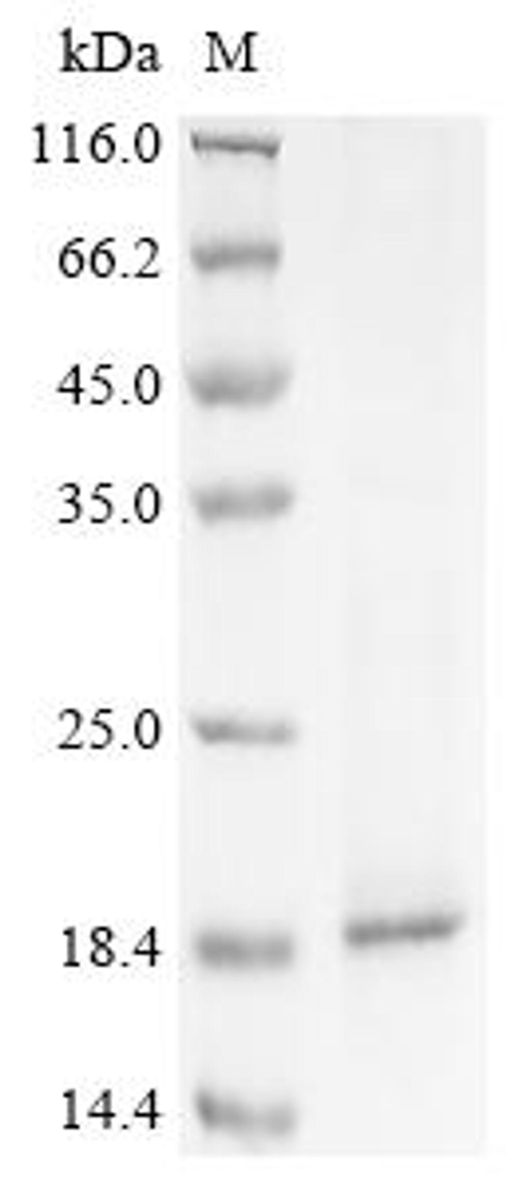 (Tris-Glycine gel) Discontinuous SDS-PAGE (reduced) with 5% enrichment gel and 15% separation gel.