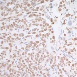 Detection of human MAD2 by immunohistochemistry.