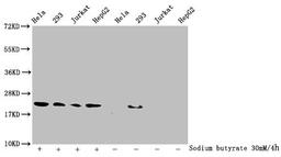 Western Blot. Detected samples: Hela whole cell lysate, 293 whole cell lysate, Jurkat whole cell lysate, HepG2 whole cell lysate; Untreated (-) or treated (+) with 30mM sodium butyrate for 4h. All lanes: HIST1H1C antibody at 1:100. Secondary. Goat polyclonal to rabbit IgG at 1/50000 dilution. Predicted band size: 22 kDa. Observed band size: 22 kDa