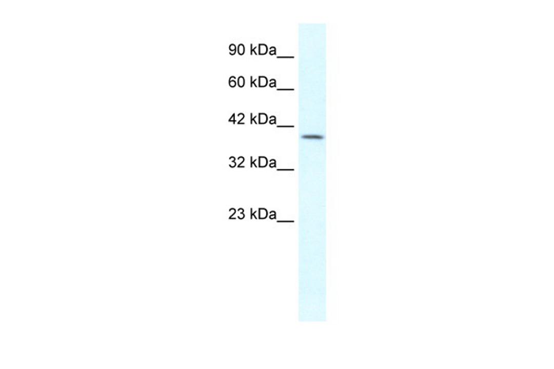 Antibody used in WB on Human Jurkat 1.25 ug/ml.