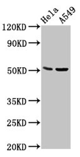 Western Blot. Positive WB detected in: Hela whole cell lysate, A549 whole cell lysate. All lanes: CHRDL1 antibody at 5.7µg/ml. Secondary. Goat polyclonal to rabbit IgG at 1/50000 dilution. Predicted band size: 52, 44, 53 kDa. Observed band size: 52 kDa