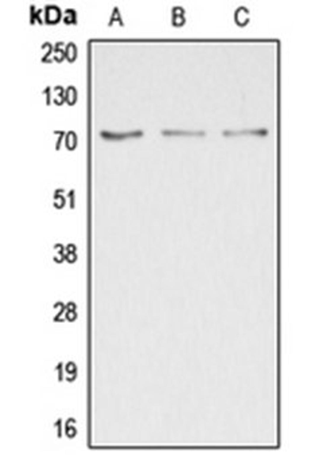 Western blot analysis of HepG2 (Lane 1), COLO205 (Lane 2), HEK293T (Lane 3) whole cell lysates using DUSP16 antibody