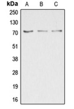 Western blot analysis of HepG2 (Lane 1), COLO205 (Lane 2), HEK293T (Lane 3) whole cell lysates using DUSP16 antibody