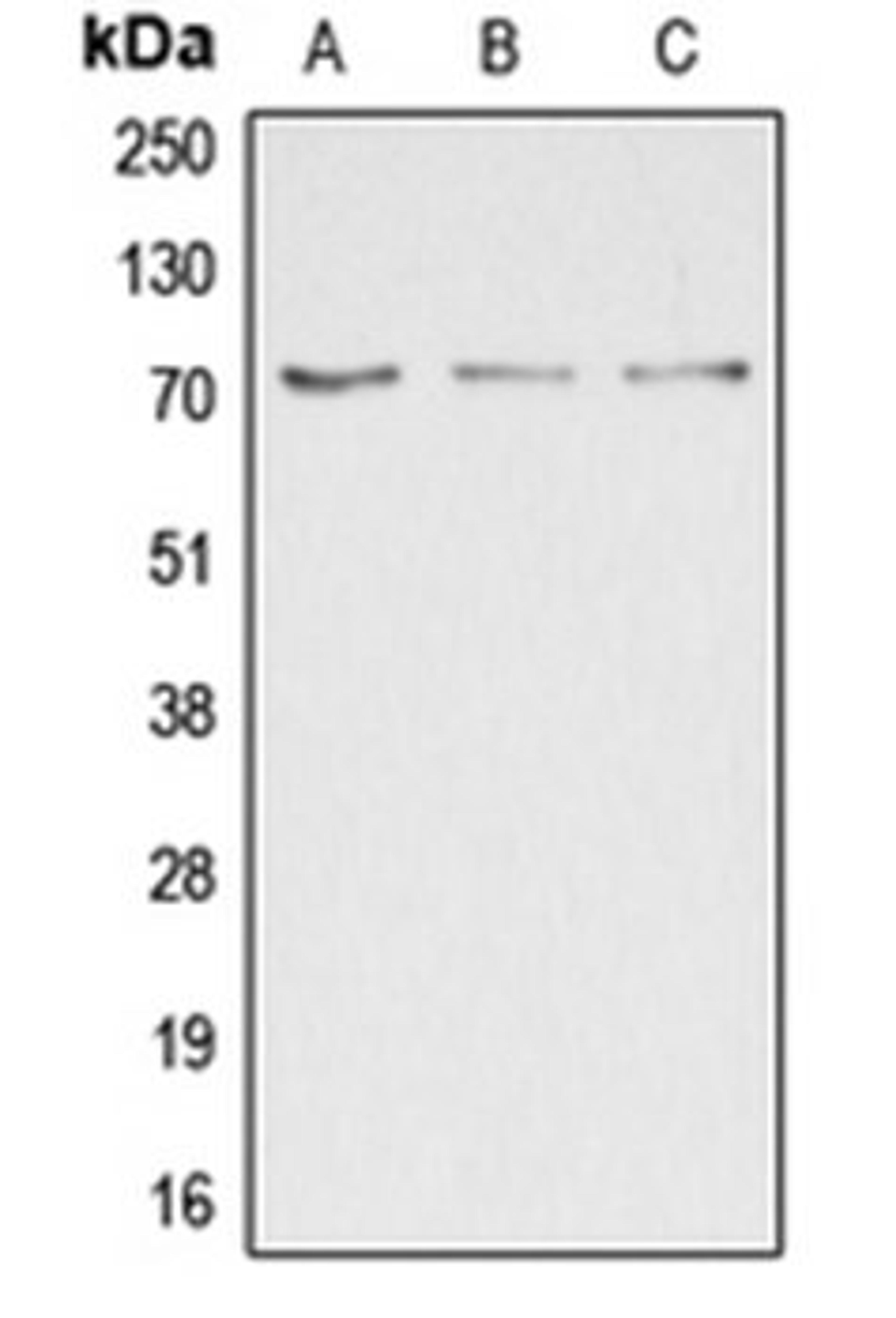 Western blot analysis of HepG2 (Lane 1), COLO205 (Lane 2), HEK293T (Lane 3) whole cell lysates using DUSP16 antibody