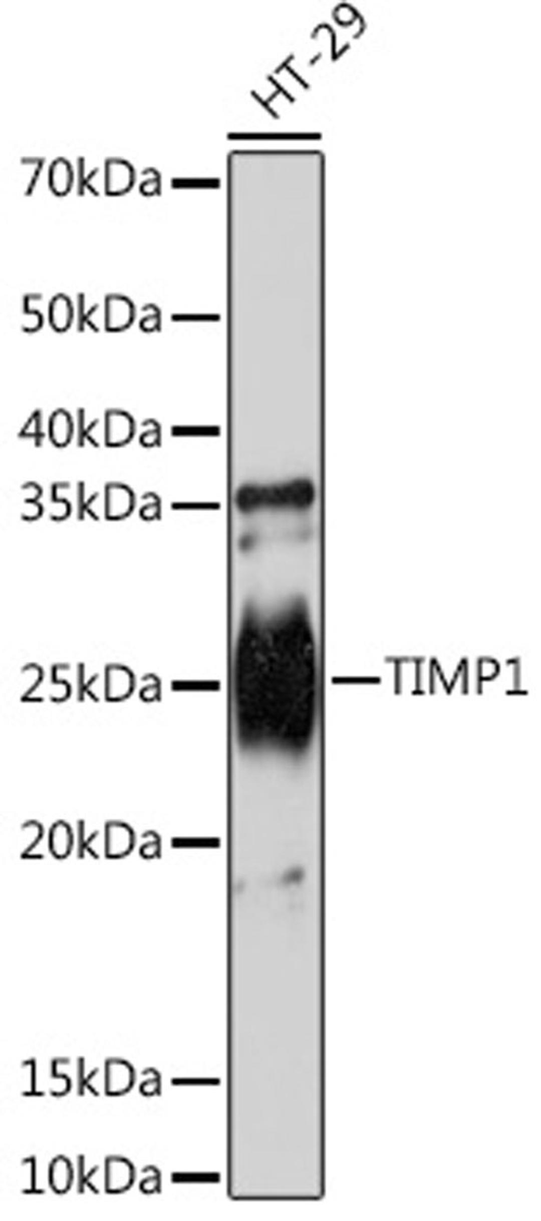 Western blot - TIMP1 Rabbit mAb (A4959)