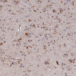 Immunohistochemistry-Paraffin: ARL8A Antibody [NBP2-14316] - Staining of human cerebral cortex shows moderate positivity in a subset of glial cells.